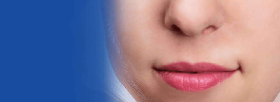 dermal fillers