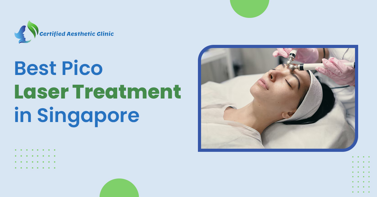 Pico Laser Treatment