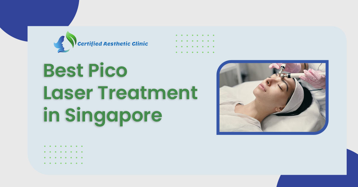 Pico Laser Treatment