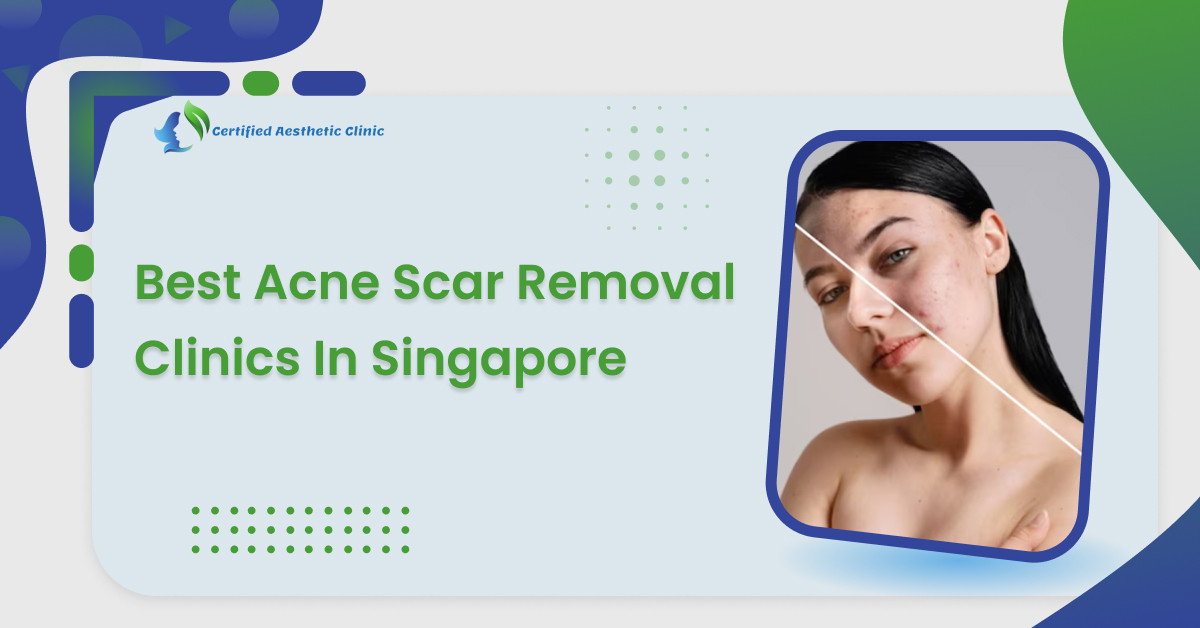 best-acne-scar-removal-clinics-in-singapore