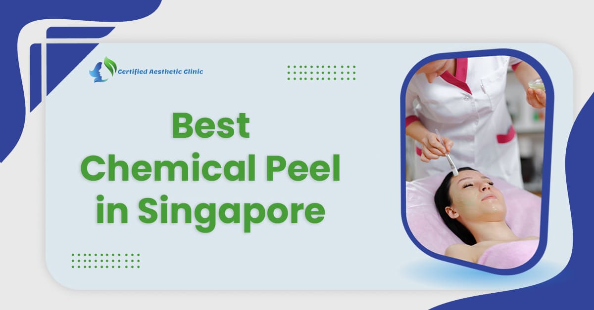 Best Chemical Peel in Singapore