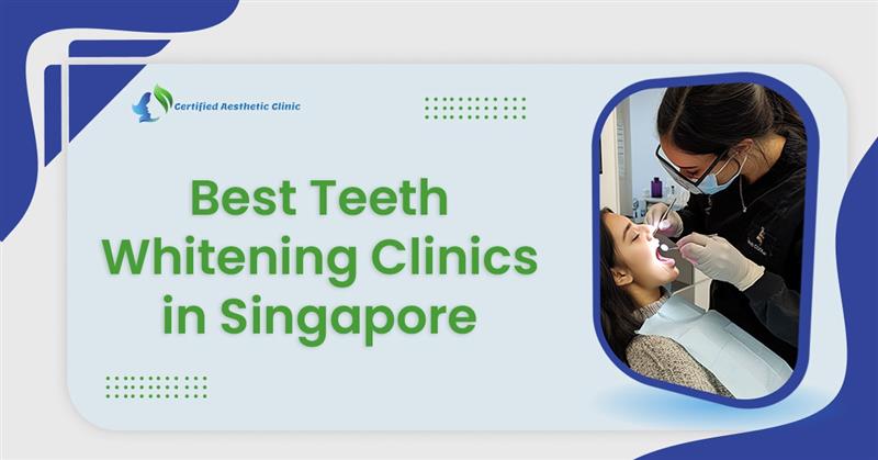 Best Teeth Whitening Clinics in Singapore