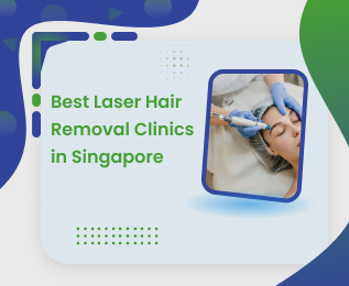 best-laser-hair-removal